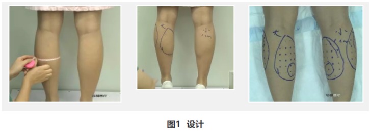 第二篇文章-（图片）.jpg