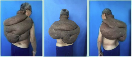 33.png