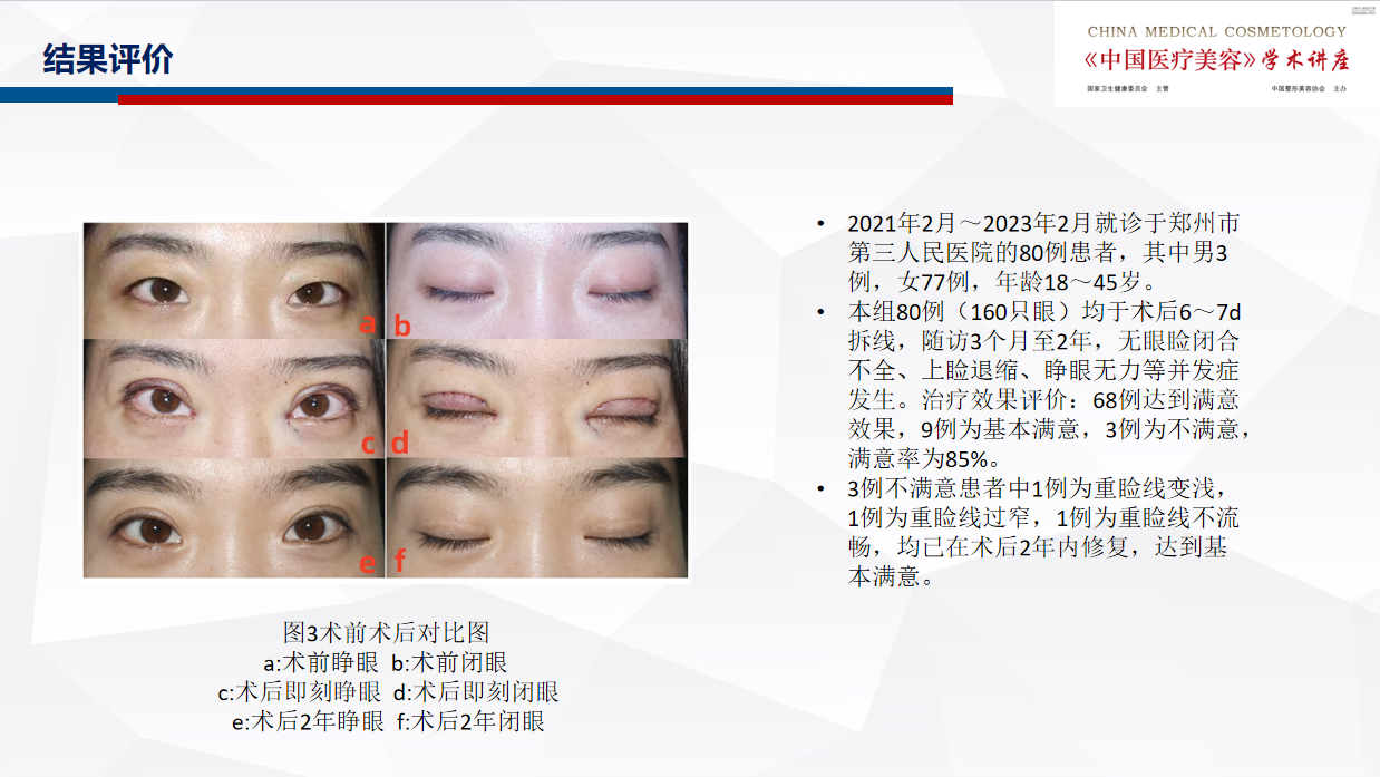 无需3.png