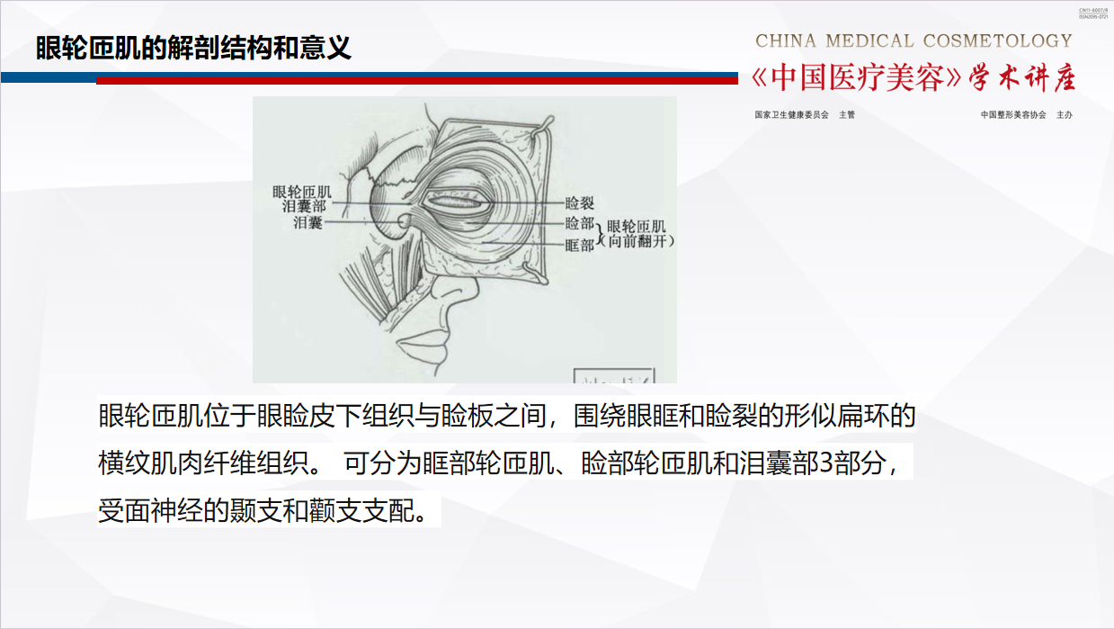 重睑术1.png